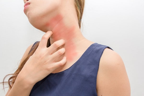 What-are-the-Symptoms-of-Allergy